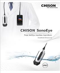 SonoEye P1