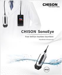 SonoEye P6